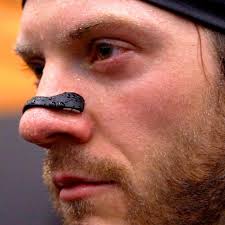 “Tiras Nasales Magnéticas – Respiración sin Barreras”