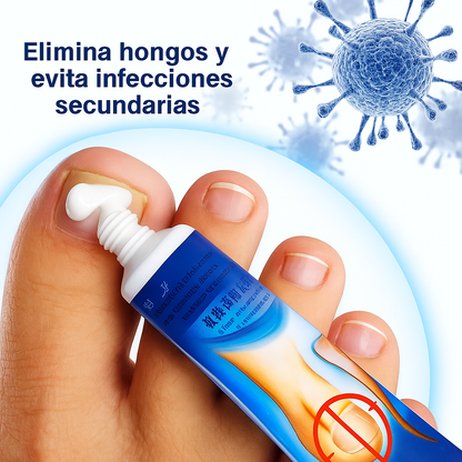 Crema Antifúngica Para Hongos